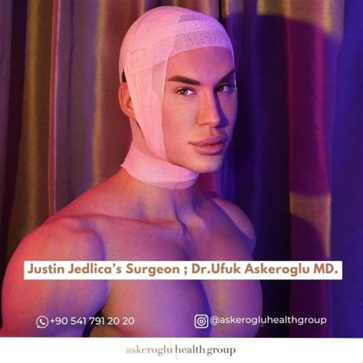 Epic Plastic Surgery Transformation Of Justin Jedlica