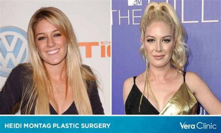 Heidi Montag Before Her Hills Fame: A Journey Of Transformation